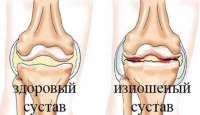 Чистые суставы - это легко! 9 отличных рецептов!