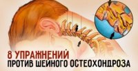 8 упражнений против шейного остеохондроза